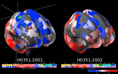 brain explorer - 3d anatomy software for windows